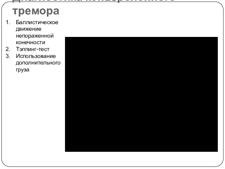 Диагностика конверсионного тремора Баллистическое движение непораженной конечности Тэппинг-тест Использование дополнительного груза
