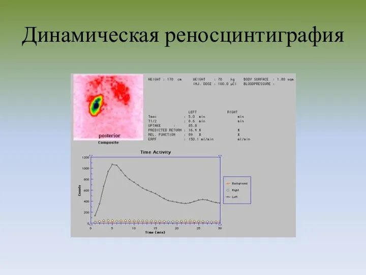 Динамическая реносцинтиграфия