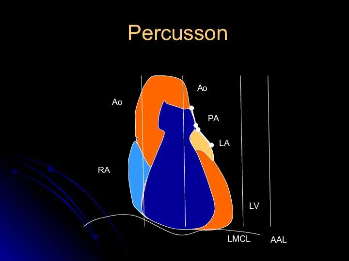 Percusson LMCL AAL Ао RA Ао PA LA LV