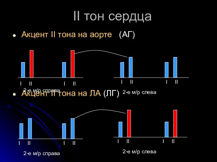 II тон сердца Акцент II тона на аорте (АГ) Акцент II