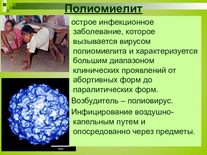 Полиомиелит острое инфекционное заболевание, которое вызывается вирусом полиомиелита и характеризуется большим