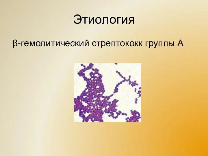 Этиология β-гемолитический стрептококк группы А