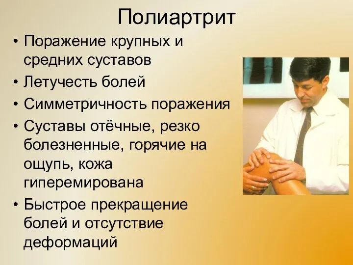 Полиартрит Поражение крупных и средних суставов Летучесть болей Симметричность поражения Суставы