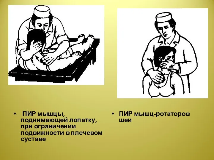 ПИР мышцы, поднимающей лопатку, при ограничении подвижности в плечевом суставе ПИР мышц-ротаторов шеи