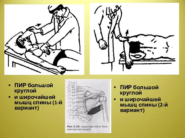 ПИР большой круглой и широчайшей мышц спины (1-й вариант) ПИР большой