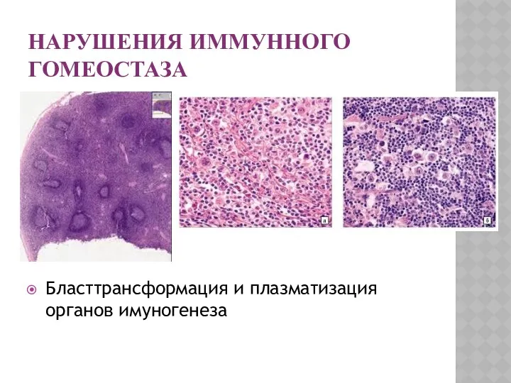 НАРУШЕНИЯ ИММУННОГО ГОМЕОСТАЗА Бласттрансформация и плазматизация органов имуногенеза