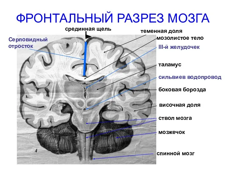 ФРОНТАЛЬНЫЙ РАЗРЕЗ МОЗГА срединная щель теменная доля мозолистое тело III-й желудочек