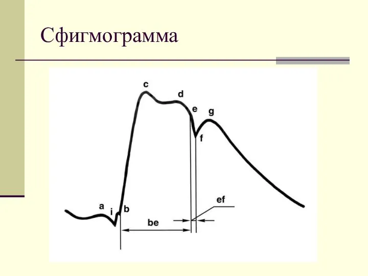 Сфигмограмма