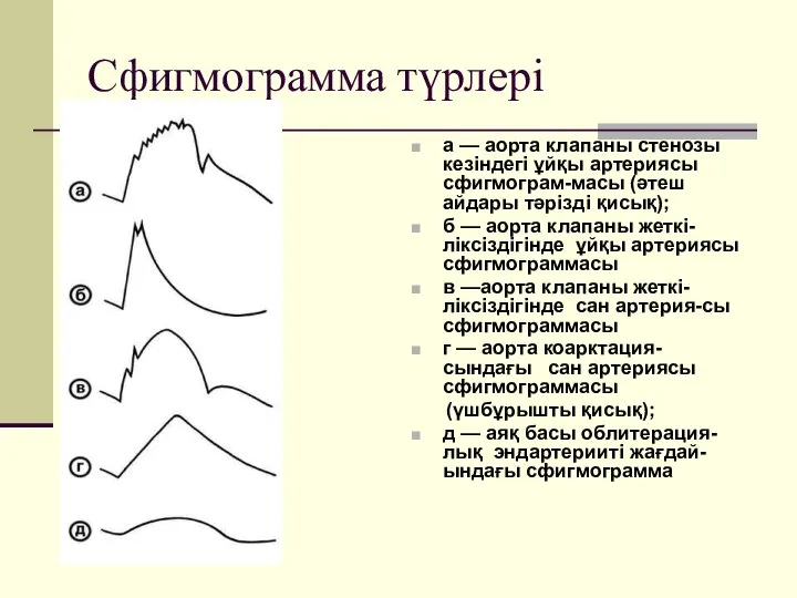 Сфигмограмма түрлері а — аорта клапаны стенозы кезіндегі ұйқы артериясы сфигмограм-масы