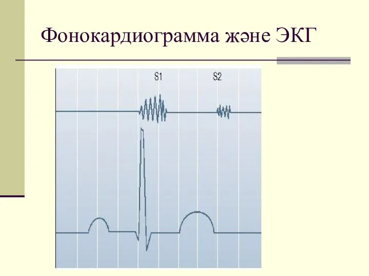 Фонокардиограмма және ЭКГ