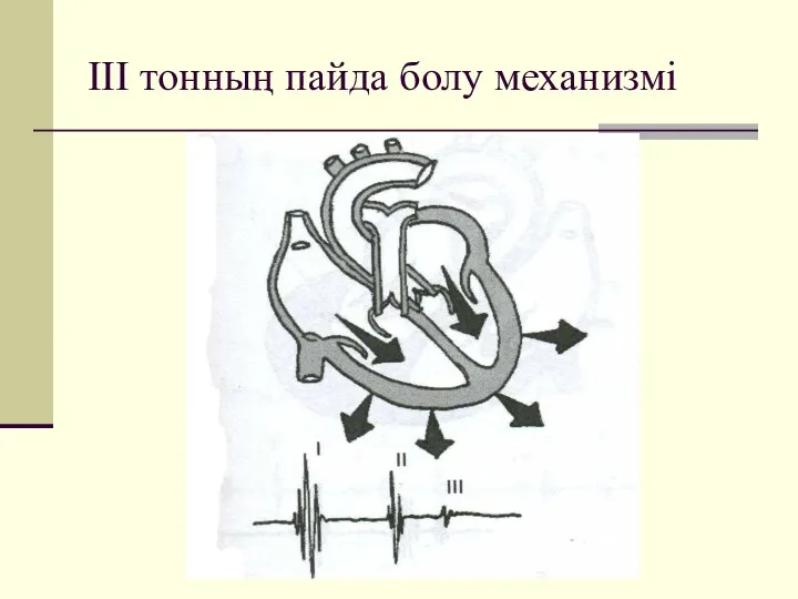 ІІІ тонның пайда болу механизмі