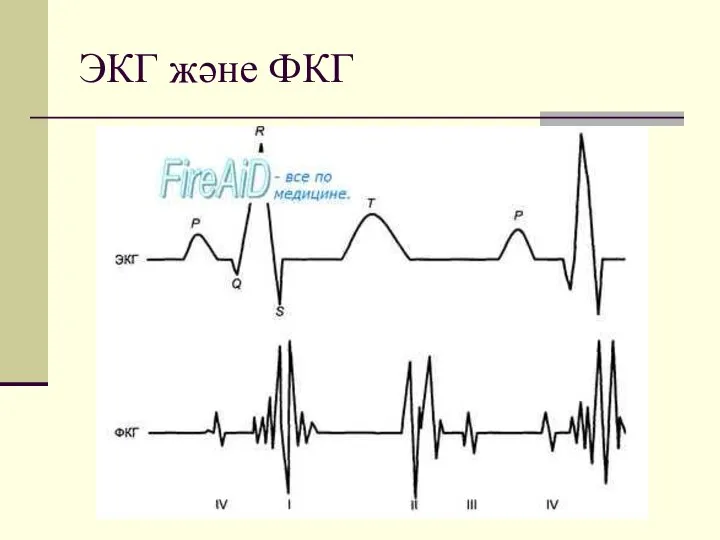 ЭКГ және ФКГ