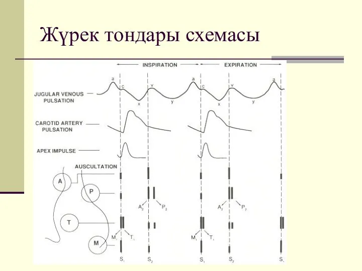 Жүрек тондары схемасы