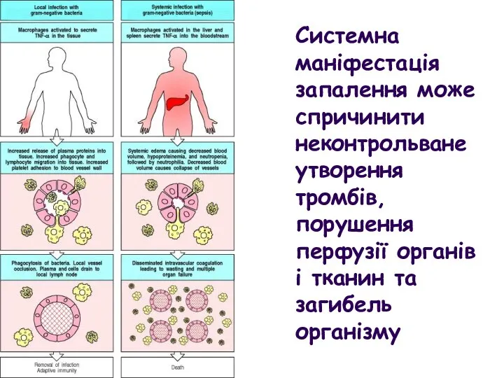 Системна маніфестація запалення може спричинити неконтрольване утворення тромбів, порушення перфузії органів і тканин та загибель організму