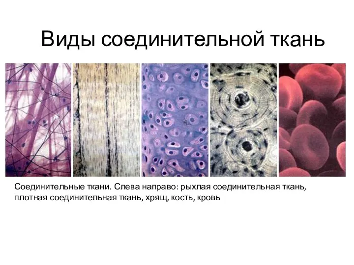 Виды соединительной ткань Соединительные ткани. Слева направо: рыхлая соединительная ткань, плотная соединительная ткань, хрящ, кость, кровь