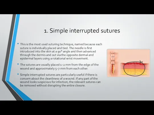 1. Simple interrupted sutures This is the most used suturing technique,