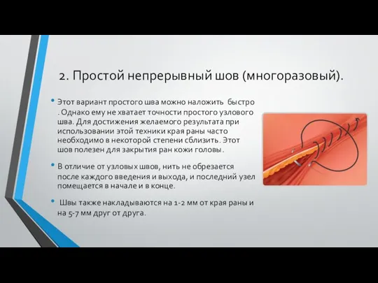 2. Простой непрерывный шов (многоразовый). Этот вариант простого шва можно наложить