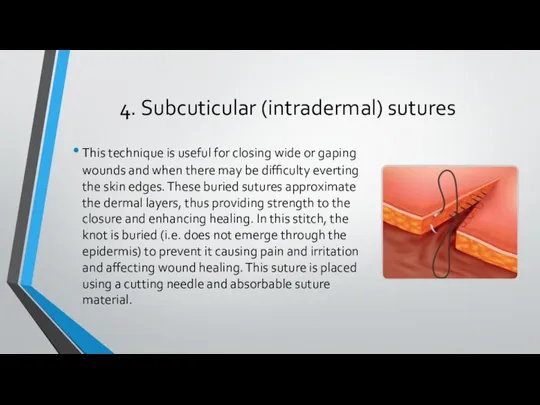 4. Subcuticular (intradermal) sutures This technique is useful for closing wide