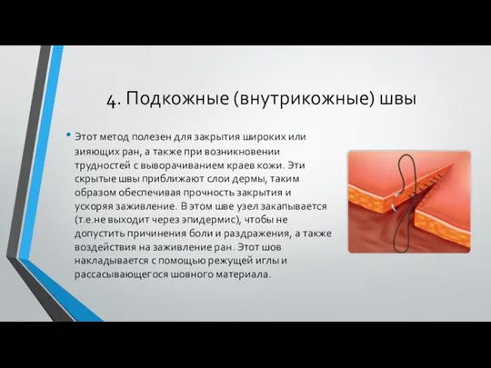 4. Подкожные (внутрикожные) швы Этот метод полезен для закрытия широких или