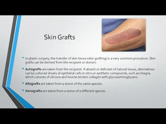 Skin Grafts In plastic surgery, the transfer of skin tissue (skin