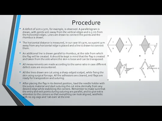 Procedure A defect of 2cm x 3cm, for example, is observed.