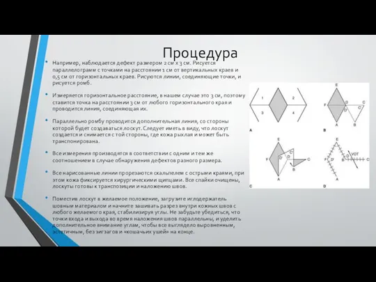 Процедура Например, наблюдается дефект размером 2 см х 3 см. Рисуется