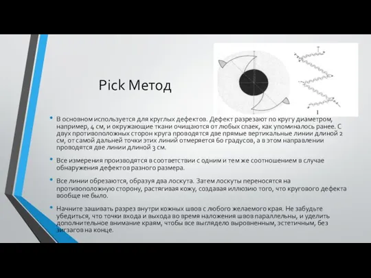 Pick Метод В основном используется для круглых дефектов. Дефект разрезают по