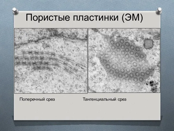 Пористые пластинки (ЭМ) Поперечный срез Тангенциальный срез