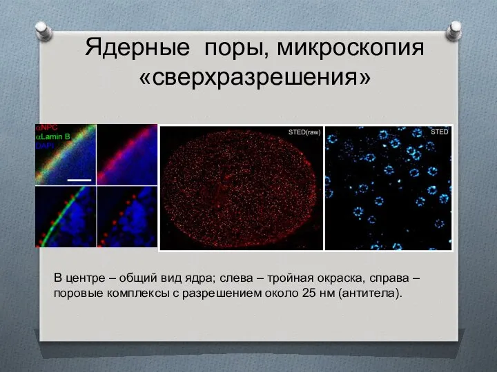 Ядерные поры, микроскопия «сверхразрешения» В центре – общий вид ядра; слева