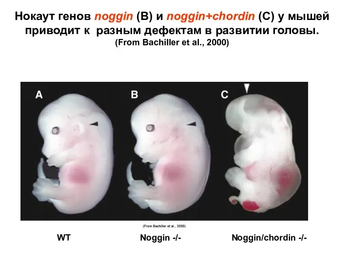 Нокаут генов noggin (В) и noggin+chordin (С) у мышей приводит к