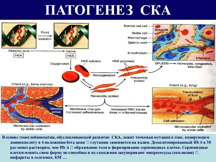 ПАТОГЕНЕЗ СКА В основе гемоглобинопатии, обусловливающей развитие СКА, лежит точковая мутация