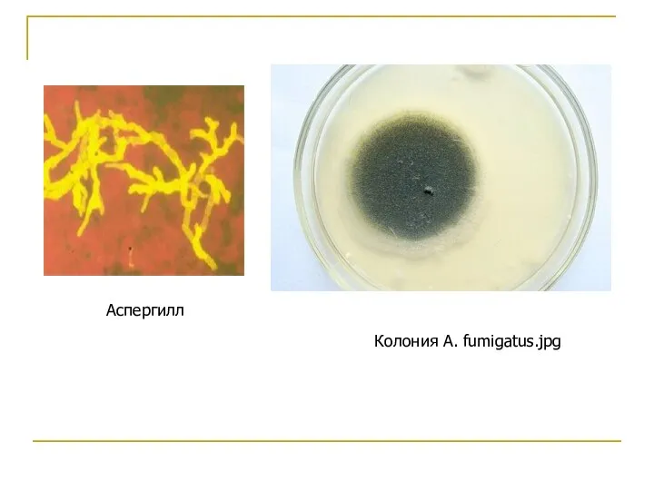 Колония A. fumigatus.jpg Аспергилл