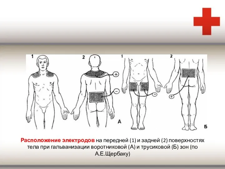 Расположение электродов на передней (1) и задней (2) поверхностях тела при