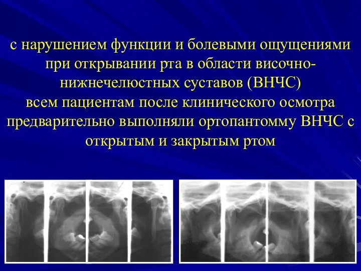 с нарушением функции и болевыми ощущениями при открывании рта в области