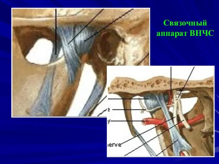 Связочный аппарат ВНЧС