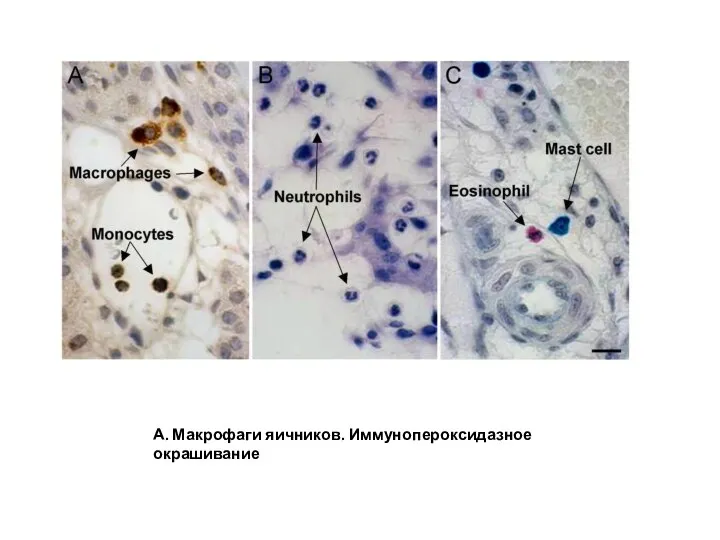 А. Макрофаги яичников. Иммунопероксидазное окрашивание