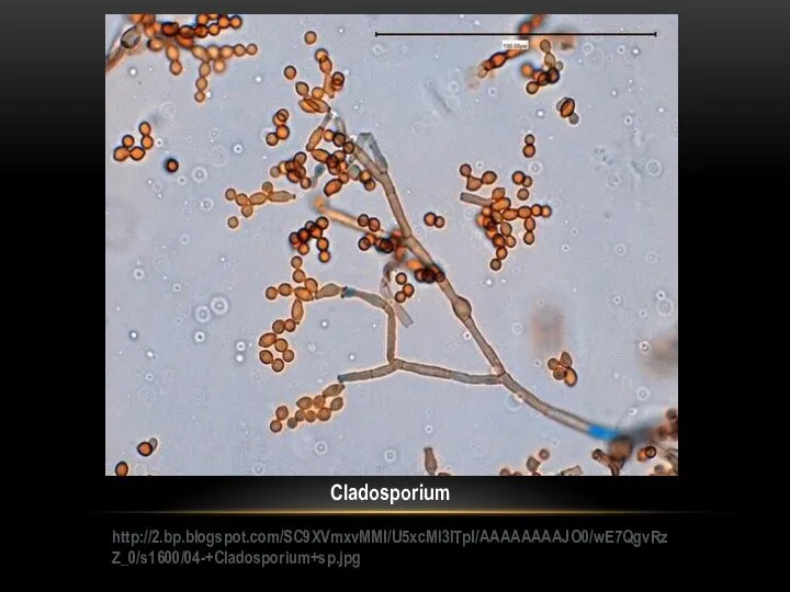 Cladosporium http://2.bp.blogspot.com/SC9XVmxvMMI/U5xcMl3lTpI/AAAAAAAAJO0/wE7QgvRzZ_0/s1600/04-+Cladosporium+sp.jpg