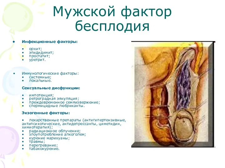 Мужской фактор бесплодия Инфекционные факторы: • орхит; • эпидидимит; • простатит;