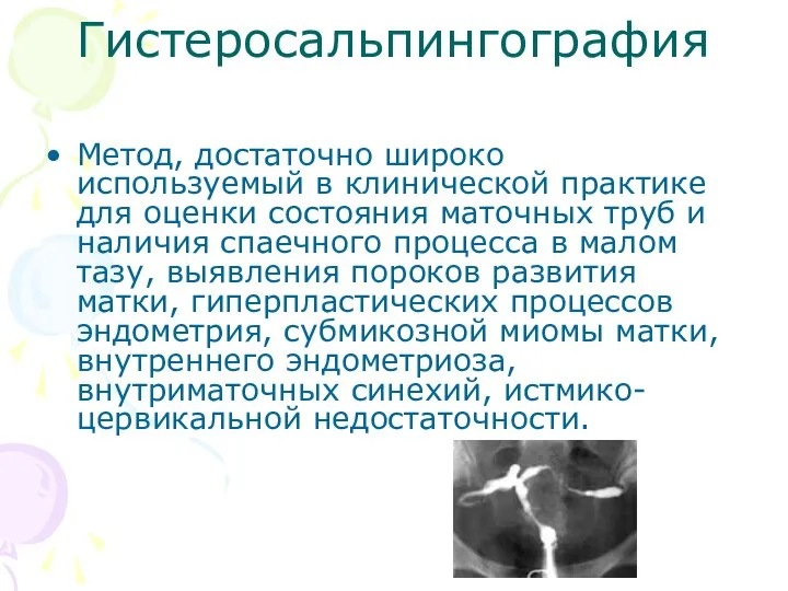 Гистеросальпингография Метод, достаточно широко используемый в клинической практике для оценки состояния