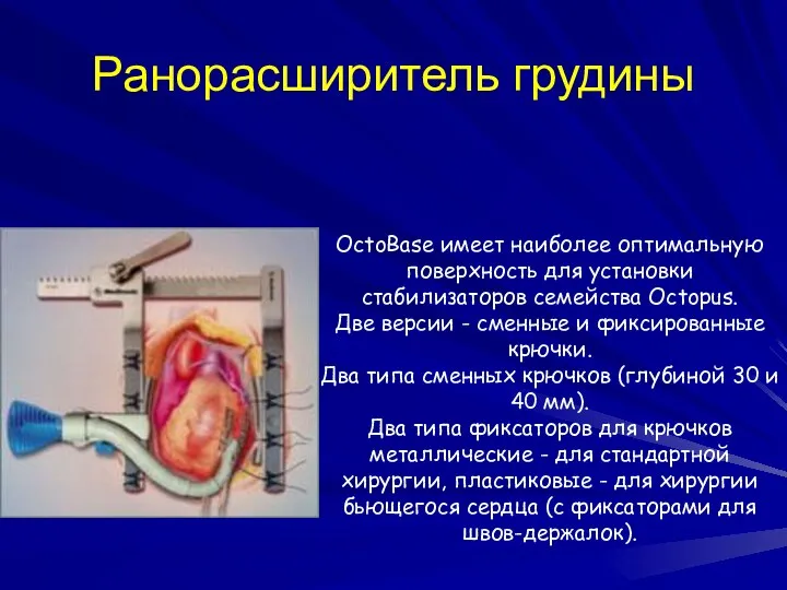 Ранорасширитель грудины OctoBase имеет наиболее оптимальную поверхность для установки стабилизаторов семейства
