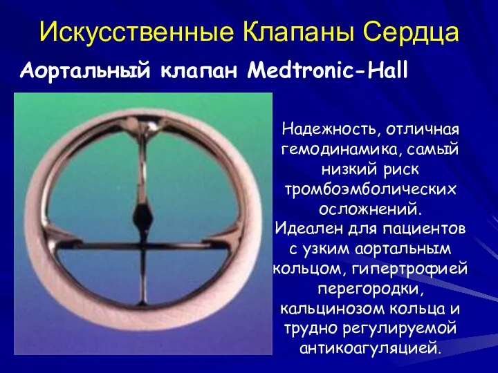 Искусственные Клапаны Сердца Аортальный клапан Medtronic-Hall Надежность, отличная гемодинамика, самый низкий