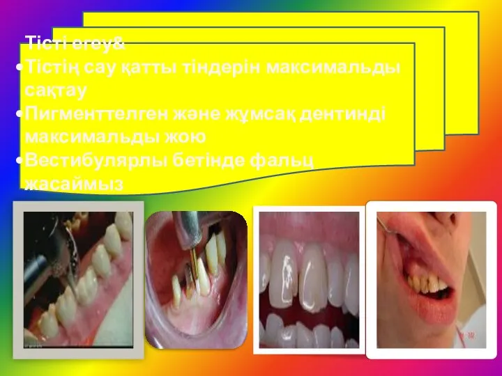 Тісті егеу& Тістің сау қатты тіндерін максимальды сақтау Пигменттелген және жұмсақ