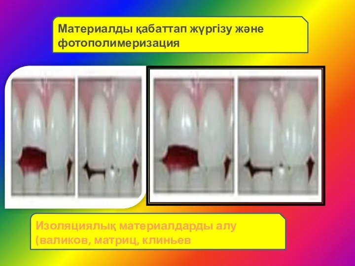 Материалды қабаттап жүргізу және фотополимеризация Изоляциялық материалдарды алу (валиков, матриц, клиньев