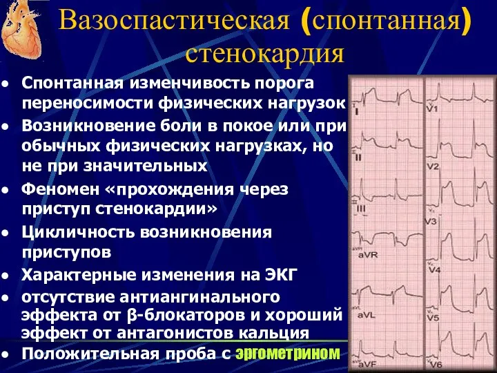 Вазоспастическая (спонтанная) стенокардия Спонтанная изменчивость порога переносимости физических нагрузок Возникновение боли