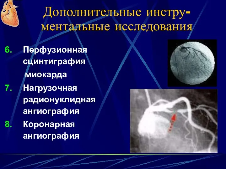 Дополнительные инстру-ментальные исследования Перфузионная сцинтиграфия миокарда Нагрузочная радионуклидная ангиография Коронарная ангиография