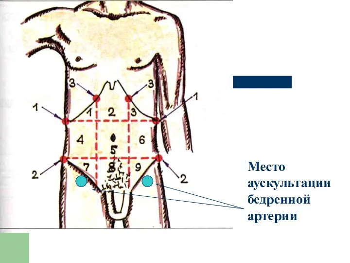 Место аускультации бедренной артерии