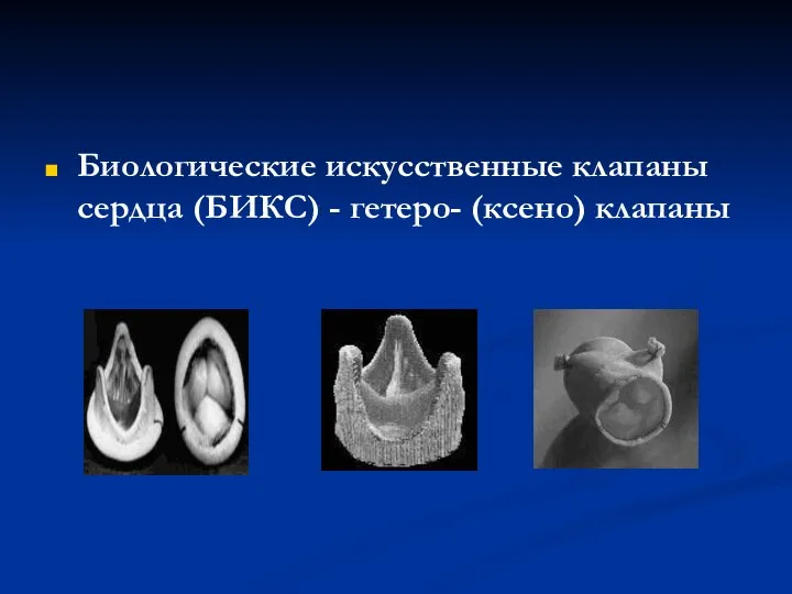 Биологические искусственные клапаны сердца (БИКС) - гетеро- (ксено) клапаны