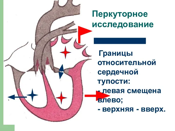 Границы относительной сердечной тупости: - левая смещена влево; - верхняя - вверх. Перкуторное исследование
