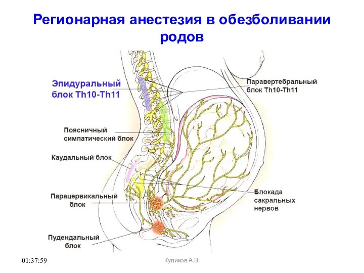 01:37:59 Регионарная анестезия в обезболивании родов Куликов А.В.