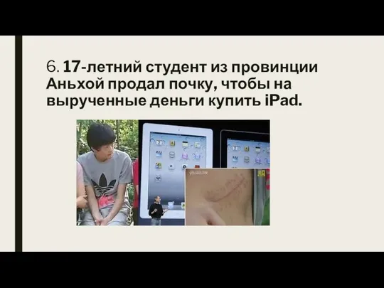6. 17-летний студент из провинции Аньхой продал почку, чтобы на вырученные деньги купить iPad.